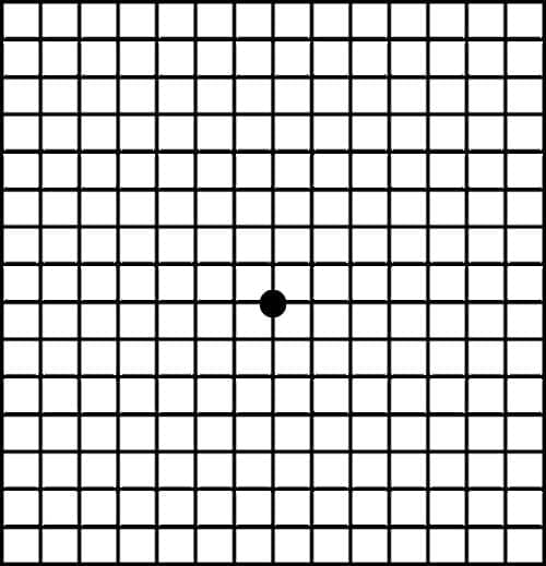 Amsler Grid Testi