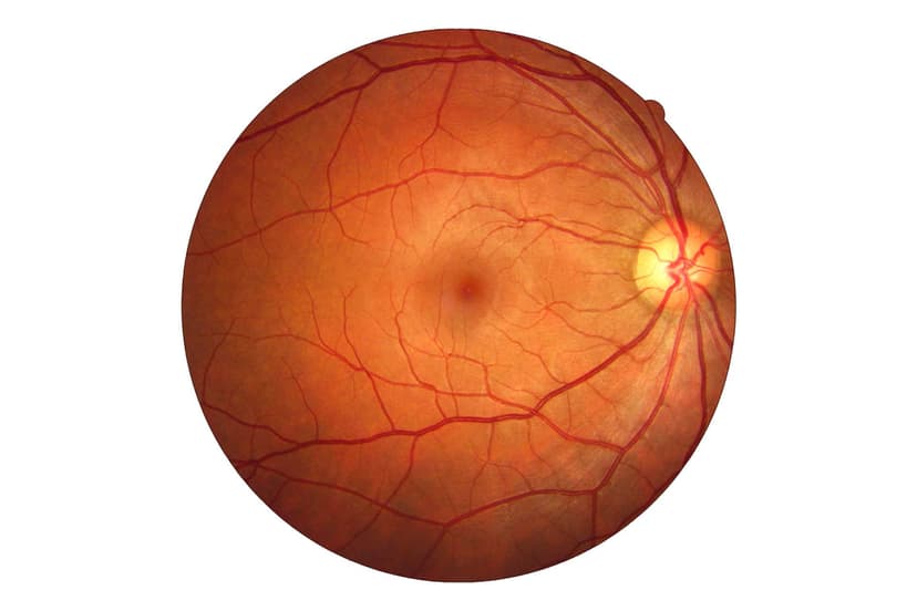 Retina